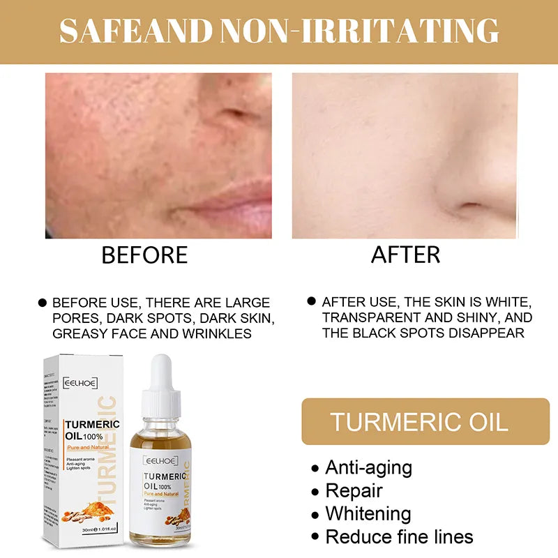 Turmeric Glow Serum: Brighten, Correct Dark Spots, and Anti-Aging - 30ml