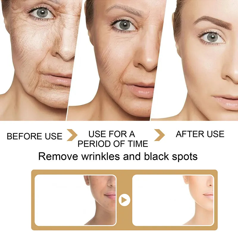 Spot Corrector Anti Aging Face Whitening Serum Care