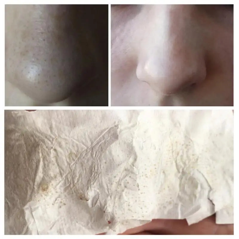 Paper Plant Pore Magic: Blackhead Remover Cream for Flawless Skin !