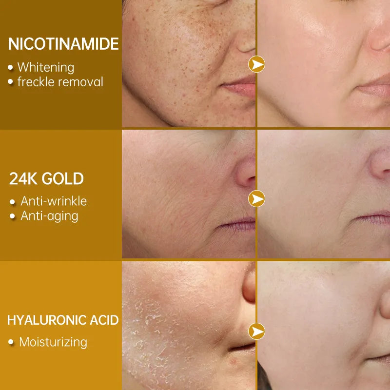 Glowing Radiance: Whitening Serum with Niacinamide, Hyaluronic Acid & 24K Gold!